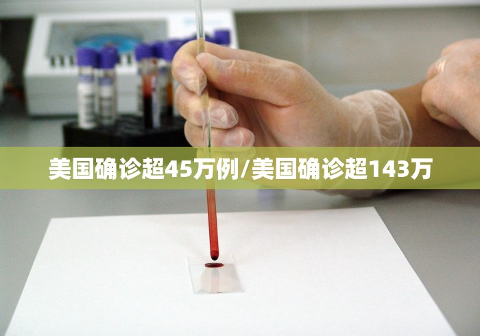 美国确诊超45万例/美国确诊超143万